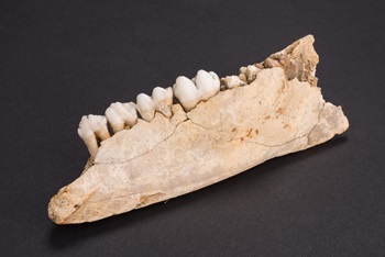 Bone